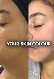 Korean Whitening Gold Cream